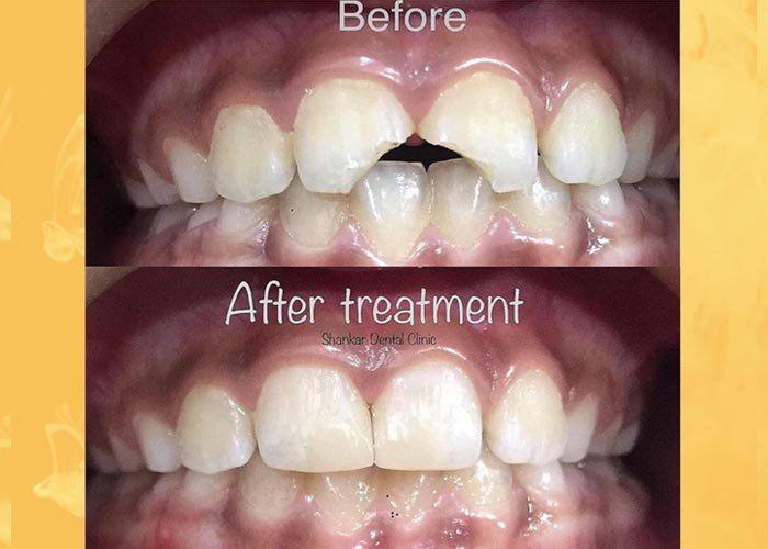Shankar Dental Clinic, Ramnagar, District - Nainital, Uttarakhand, India