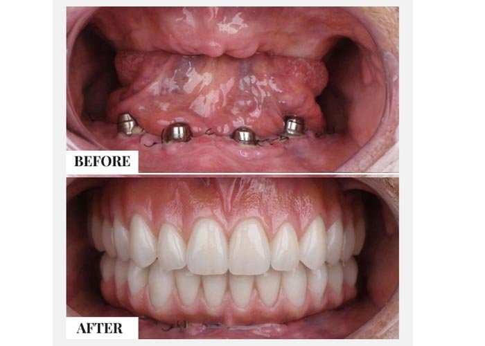 Shankar Dental Clinic, Ramnagar, District - Nainital, Uttarakhand, India