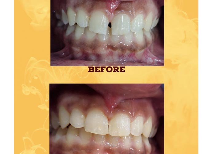 Shankar Dental Clinic, Ramnagar, District - Nainital, Uttarakhand, India
