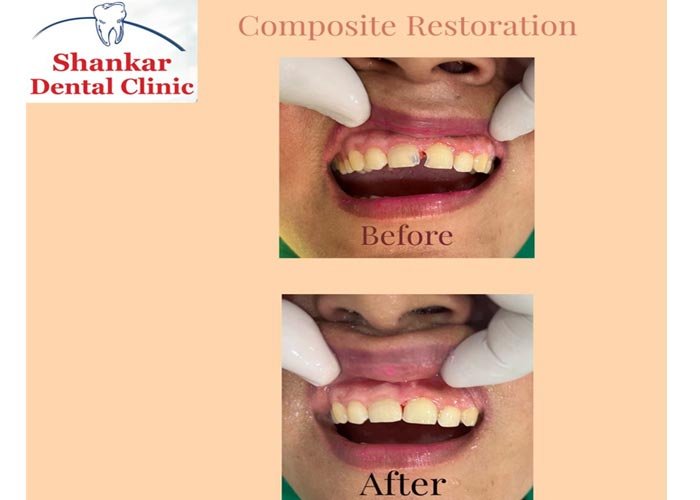 Shankar Dental Clinic, Ramnagar, District - Nainital, Uttarakhand, India