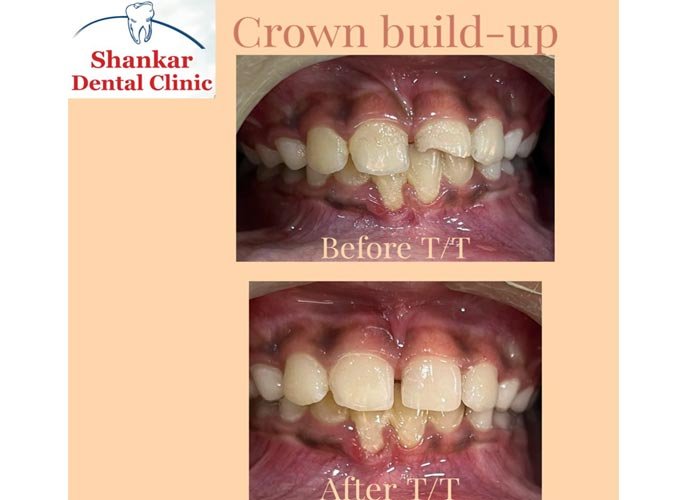 Shankar Dental Clinic, Ramnagar, District - Nainital, Uttarakhand, India