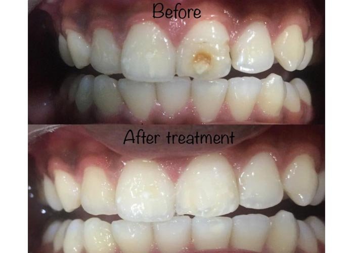 Shankar Dental Clinic, Ramnagar, District - Nainital, Uttarakhand, India