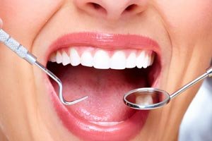 Cosmetic dentistry