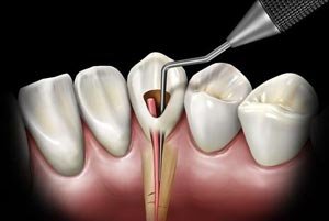 Endodontics