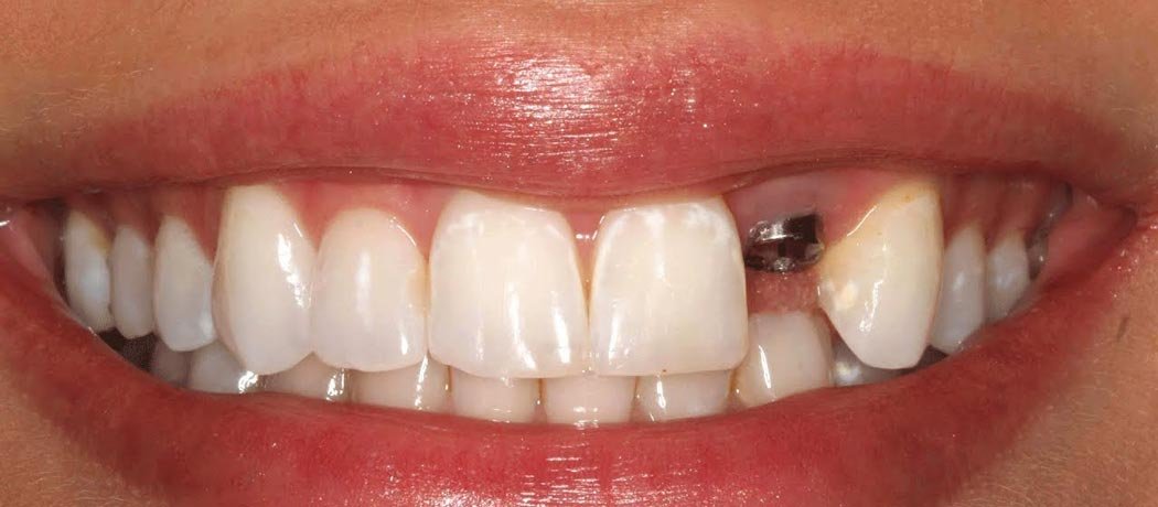 General and Preventive Dentistry, Shankar Dental Clinic, Ramnagar, Nainital